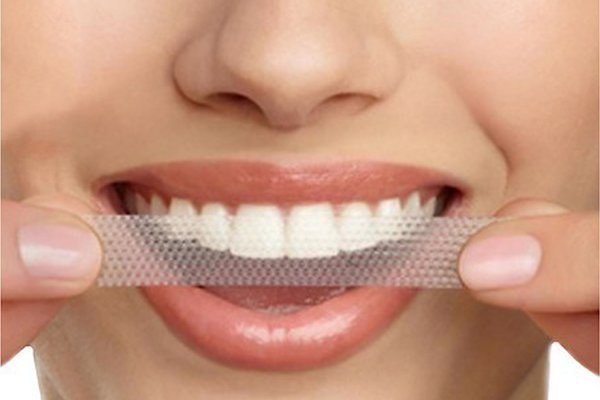 Best Teeth Whitening Kits Reviews